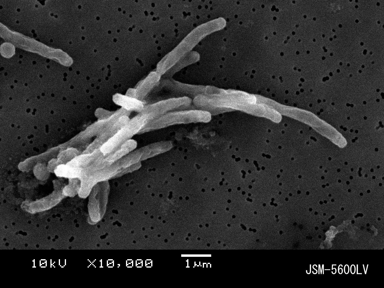 東京都感染症情報センター 結核菌の電子顕微鏡写真 その１