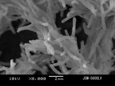 結核菌の電子顕微鏡写真 その２