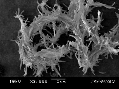 結核菌の電子顕微鏡写真 その３