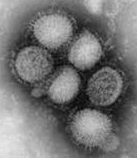 インフルエンザウイルスの電子顕微鏡写真