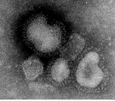 インフルエンザ電子顕微鏡写真