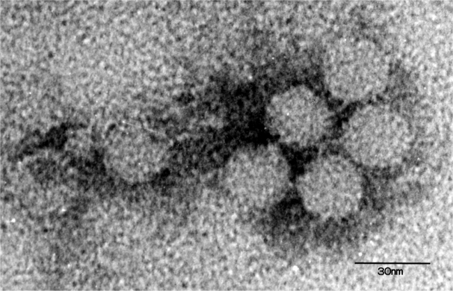 Ａ型肝炎ウイルスの電子顕微鏡写真