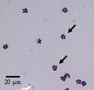 図1． Kudoa septempunctataの胞子（ギムザ染色標本）