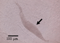 図3　ヒラメ筋肉中のKudoa septempunctataの偽シスト