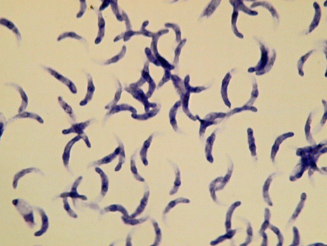 図6. Sarcocystis fayeriブラディゾイト（ギムザ染色標本）